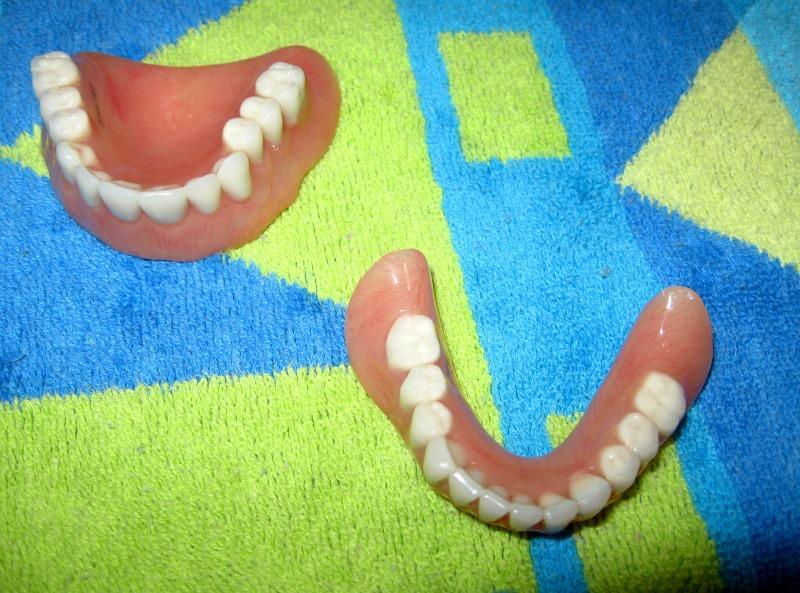 upper and lower dentures