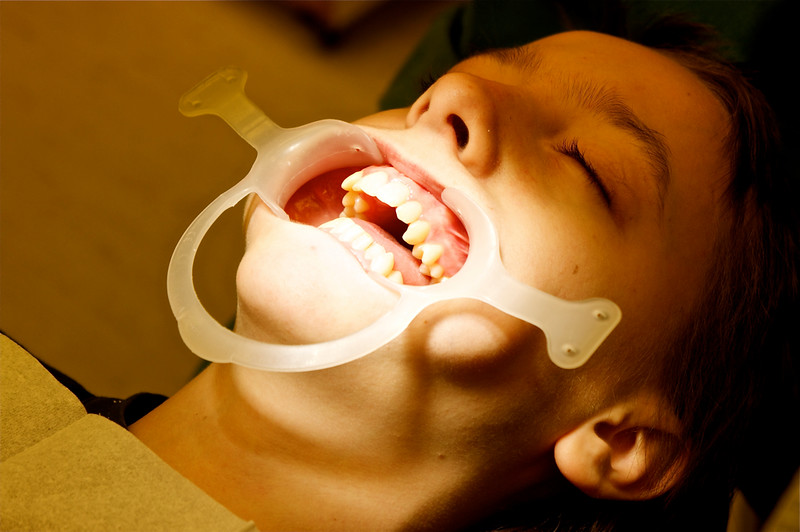 Dental Patient Under Treatment