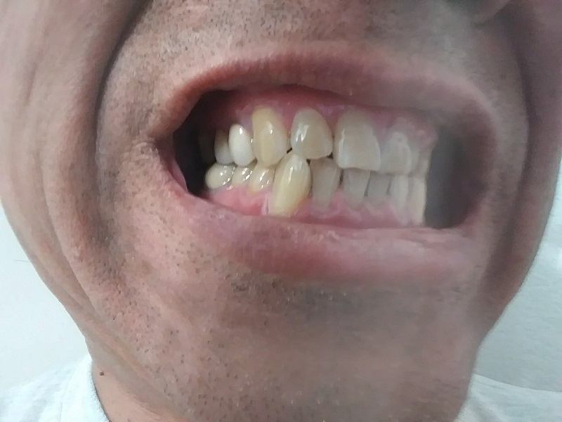 man showing his teeth and gums
